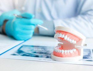 Dentist’s hands at desk with X-rays, paperwork, and model teeth