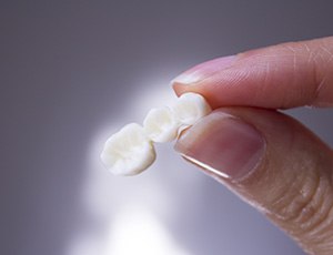 Woman holding a dental bridge