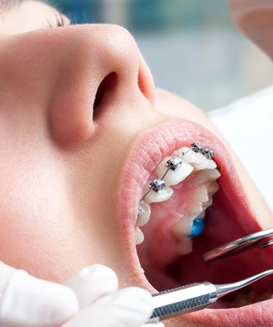 Teenager getting a dental checkup
