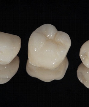 three dental crowns