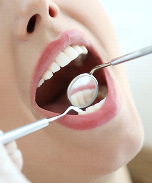 Woman during a routine dental cleaning.
