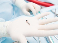 A dental professional wearing gloves holds a titanium dental implant in their hand