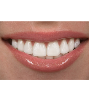 Close up of white teeth